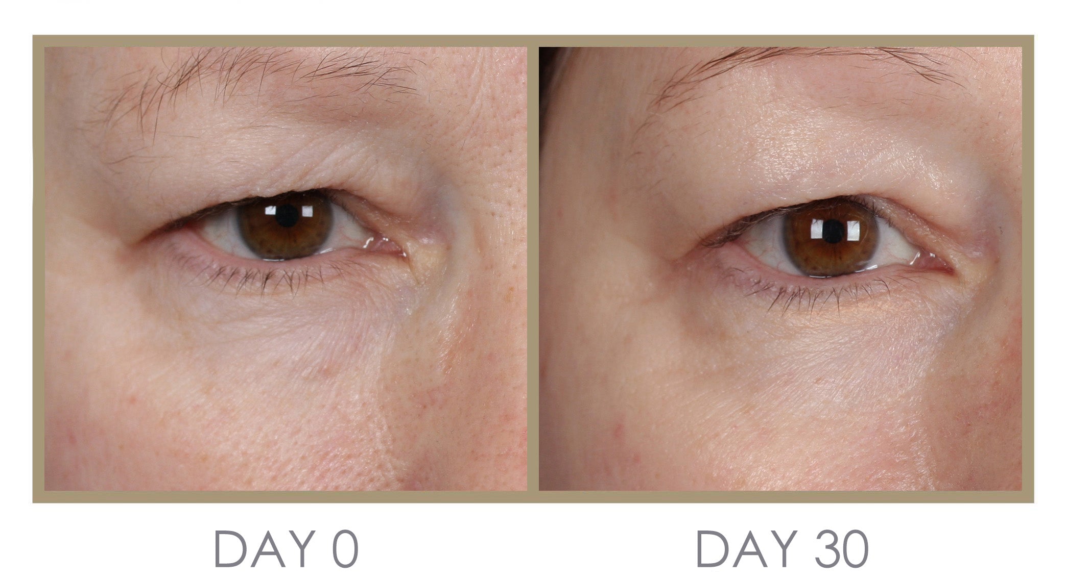 Pre Order H'eye'drator Eye Cream